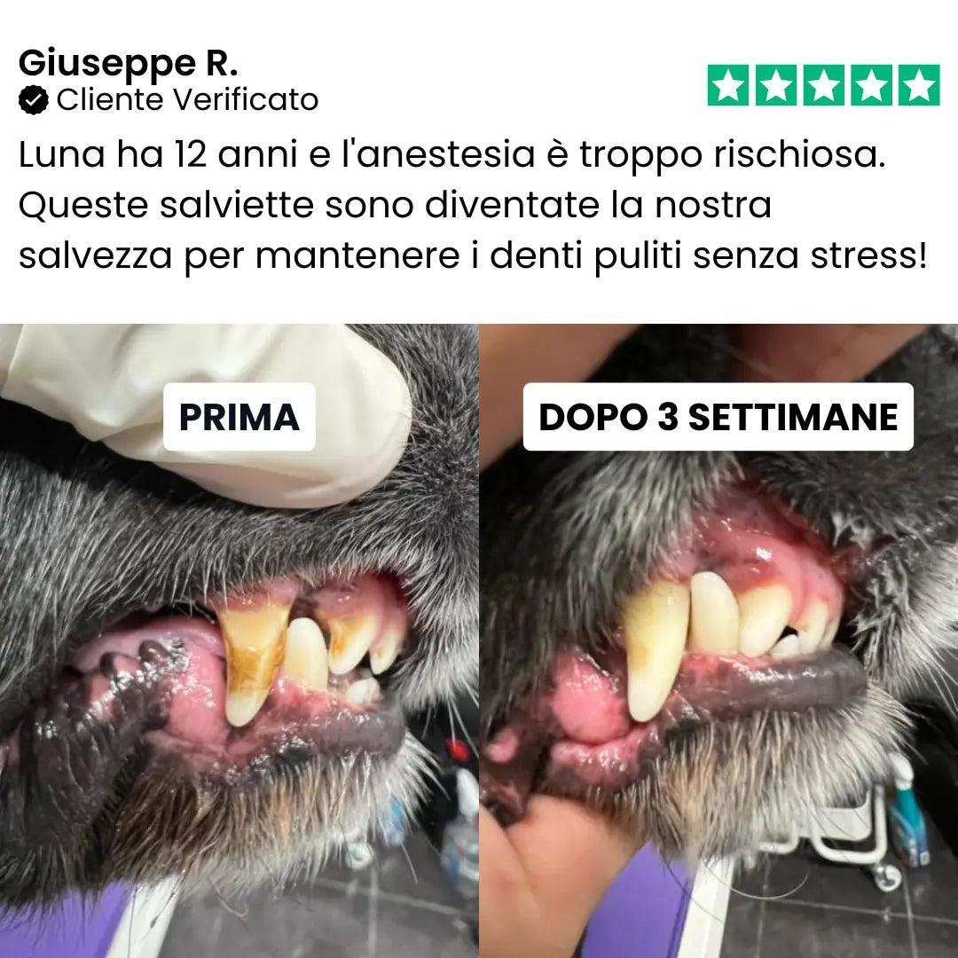 Salviette Denti