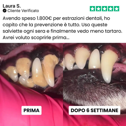 Salviette Denti