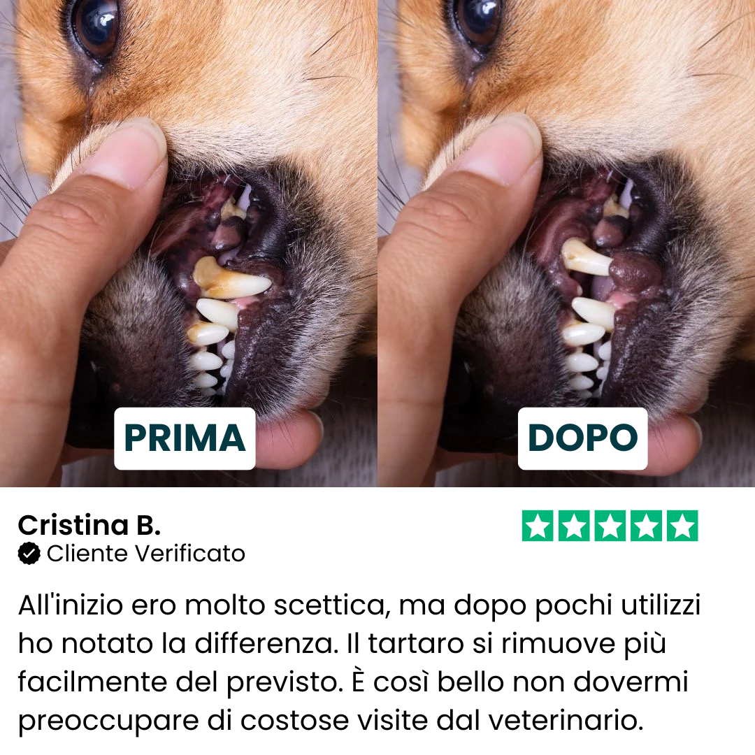Kit Anti-Tartaro ad Ultrasuoni