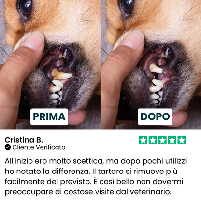Kit Anti-Tartaro ad Ultrasuoni